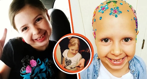 7-jähriges Mädchen mit plötzlichem Haarausfall findet Schönheit in der Glatze, indem sie ihren Kopf schmückt